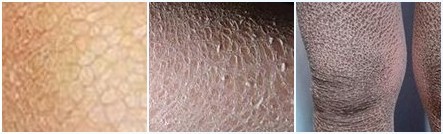 ���۲��ĳ���֢״