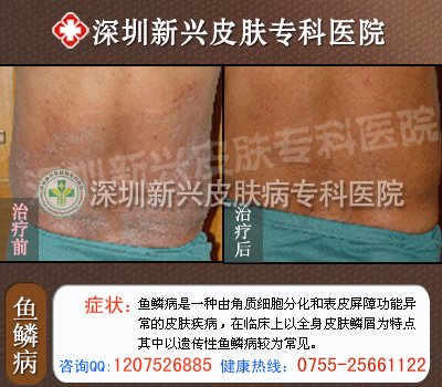 ��������Ƥ����ר��