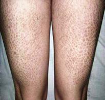 Ѱ�������۲�