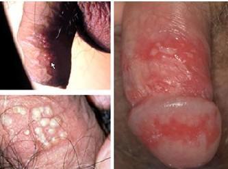 深圳新兴皮肤专科