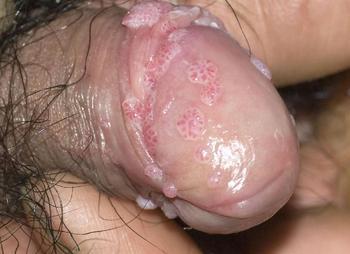 ��������Ƥ����ר��