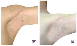 深圳新兴皮肤专科