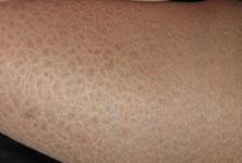 ��������Ƥ����ר��