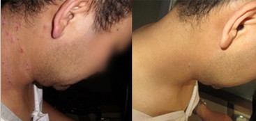 上海最好的皮肤病医院 上海江东医院