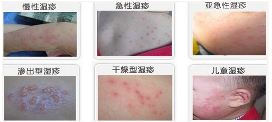 ʪ��ĸ�������